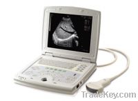 Sell Full Digital Laptop Ultrasound Scanner (KX5000)