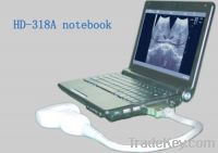 Sell HD-318A Notebook B Ultrasound Scanner