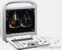 Sell V3 Color Doppler B Ultrasound Scanner