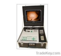 Sell  mammary gland infrared diagnostic instrument