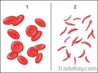Sell Anemia treatment