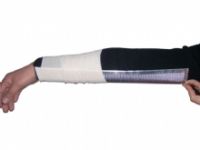 Sell Extremities Splint Series