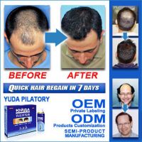 Sell Anti Hair Loss, stop hair loss in 3 days and hair grow in 7days