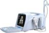 Portable Digital Ultrasound Diagnostic Scanner