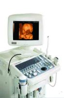 Sell Accuvix SA8000 Live Ultrasound for Diagnosis