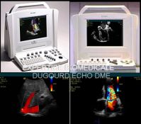 Sell ultrasound scanner Acuson Cypres Preowned cardiovascular