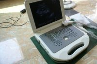 Sell laptop ultrasound scanner BEU-8360A