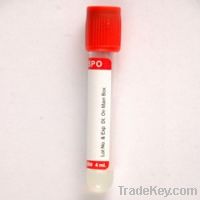 Serum Sepration Tube