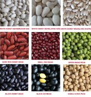 light speckled kidney beans sugar bean pinto bean for sale