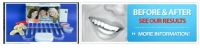 Sell Professional Teeth Whitening  Kits