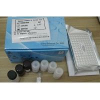 Human 2-aminoadipic acid (2-AAA) ELISA Kit