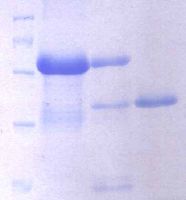 Highly purified recombinant enterokinae with high activity.