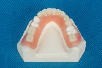 Sell acrylic denture