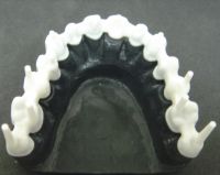 zirconia crowns