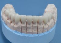 zirconia crown