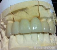 Sell metal free zirconia crown/bridge