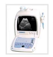 Sell Portable Ultrasound Scanner OSEN800