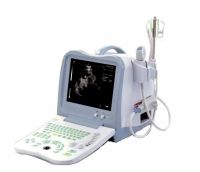 Sell Digital Ultrasound Scanner (BW530)