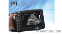 Portable Digital B-mode Ultrasonic Diagnostic Instrument HD-9200