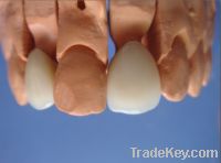 Sell Dental Porcelain fused to metal crown