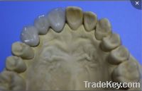 Sell dental porcelain fusedd to metal crown