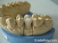Sell dental porelain fused to metal crown