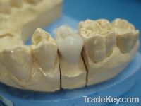 Sell dental porcelain metal crown