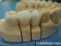 Sell dental ceramic cast to metal crown