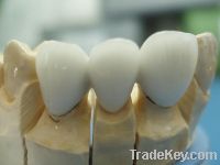 Sell dental ceramic cast metal crown
