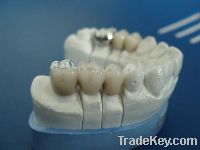 Sell dental ceramic crown
