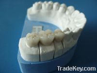 Sell dental porcelain crown