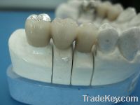 Sell dental ceramic cast metal crown