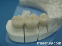 Sell dental porcelain fused to metal crown