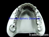 Sell Titanium partial denture