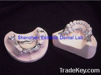 Sell dental Titanium partial denture