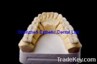 Sell dental ceramic cast to metal crown