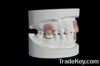 Sell acrylic denture