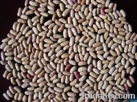 Sell New Crop Speckled Kidney Beans
