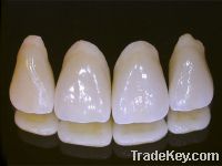 Sell dentures teeth Dental Porcelain Fused to Metal Crown/Bridge