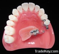 Sell dental Precision Attachments Restoration for Teeth