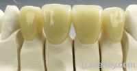 Sell false teeth Dental E.Max Crowns