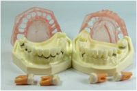 Sell Dental Oral Demonstrating Models-Periodental Disease Model