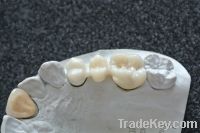 Sell Dental IPS E.max all ceramic Crown and porcelain bridge