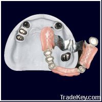 Sell Dental CAD CAM Telescope metal crown with partial acrylic denture