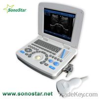 SS-10 Laptop PC Based Ultrasound B Scanner(3D image optional)