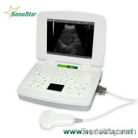 SS-3 Laptop Ultrasound B Scanner(ultrasound, ultrasoni, black white, scan