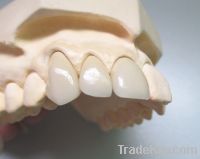 Sell Dental Porcelain fused to Pure Titanium crown (PFM)