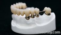 Sell Telescope inner/outer crown with partialacrylic denture