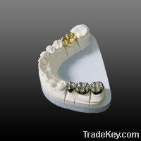 Sell Dental Full cast NP/ Gold crown and bridge(FCC)