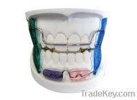 Sell Dental removable Orthodontic Frankel Functional appliance